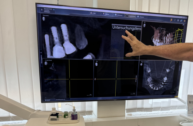 Planung von Implantaten und Zahnersatz am Bildschirm in der ACC Am Claraplatz Zahnklinik